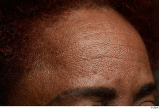 HD Face Skin Korah Wilkerson eyebrow forehead skin texture 0001.jpg